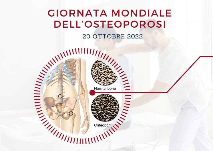 giornata mondiale osteoporosi